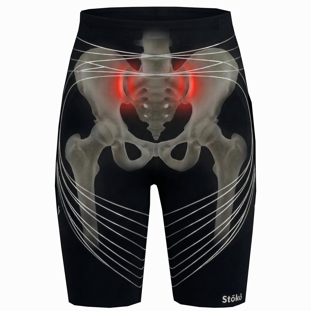 Injuries – Stoko